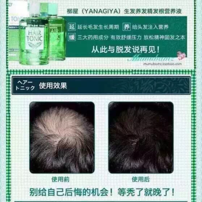 產(chǎn)后脫發(fā)怎么辦？這些方法幫你減少掉發(fā)，拒絕禿頂危機(jī)